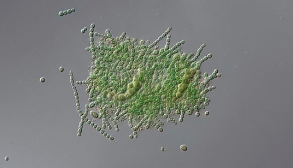 ציאנובקטריה | Hakan Kvarnstrom, Science Photo Library