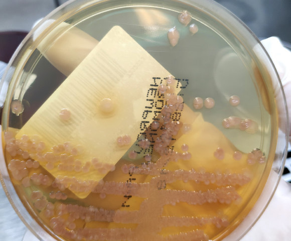 תרבית של חיידקי מורגנלה מורגני | Shutterstock, Frawash