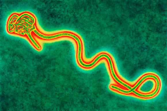 תמונת מיקרוסקופ אלקטרונים של נגיף האבולה | A. Dowsett, Health Protection Agency, Science Photo Library