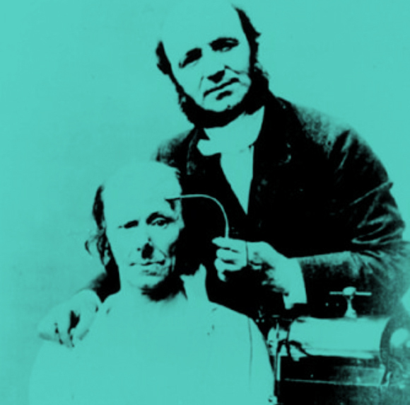 דושן מצמיד אלקטרודה לראשו של מטופל | מקור: National Library of Medicine, Science Photo Library