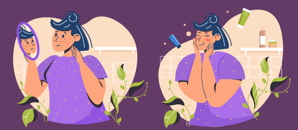 ציור של אישה הסובלת מאקנה | Shutterstock, OlyaOK