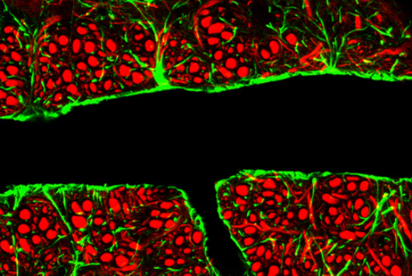 מחסום הדם-מוח | מקור: C.j.guerin, Phd, Mrc Toxicology Unit, Science photo Library