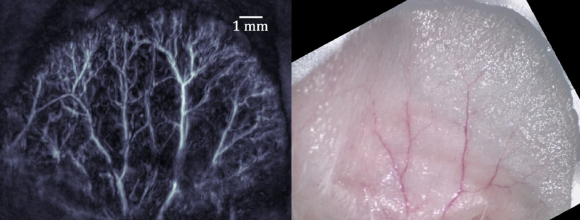 כלי דם באוזן עכבר במיקרוסקופ (ימין) ומיפוי בשיטת הדימות החדשה (שמאל) | מקור: מאמר המחקר Hazan et al