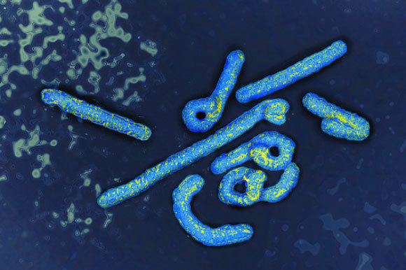 נגיפי מרבורג בצילום צבוע במיקרוסקופ אלקטרונים | מקור: JAMES CAVALLINI / SCIENCE PHOTO LIBRARY