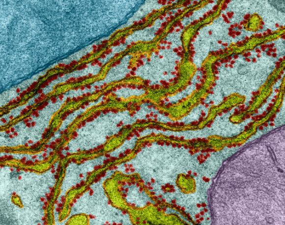 צילום מיקרוסקופ אלקטרונים צבוע של הרשתית התוך-פלזמית, בירוק-צהוב, והריבוזומים שעליה באדום |   Dennis Kunkel Microscopy, Science Photo Library