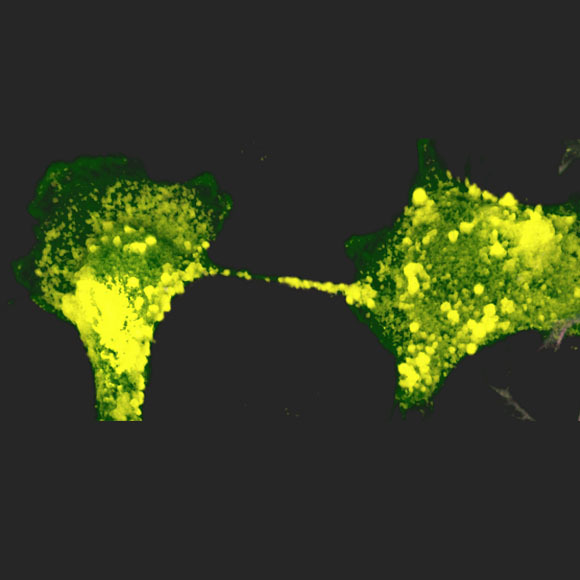 צילום מיקרוסקופ תלת מימד | מקור: Anna Pepe, Institut Pasteur
