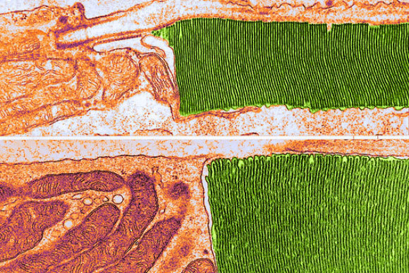 האזור הרגיש לאור בירוק, המיטוכונדריה בצד שמאל | Don w. Fawcett, science photo library