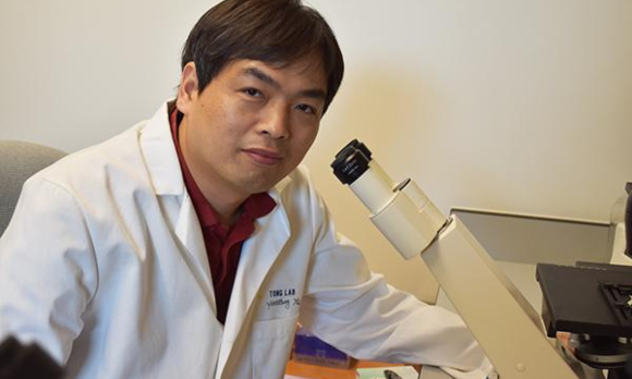 מקווים לפתח בעזרת הממצאים טיפול יעיל באנורקסיה נרבוזה. ראש צוות המחקר, קינגצ'ון טונג | צילום: אוניברסיטת יוסטון