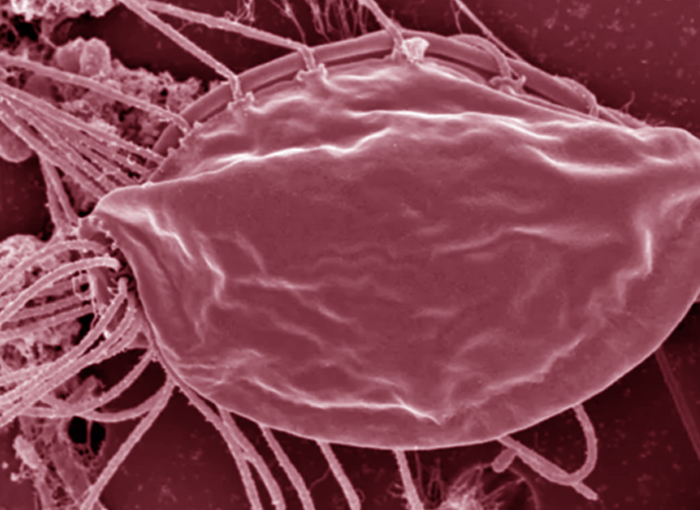 צילום במיקרוסקופ אלקטרונים סורק של ההמימסטיגוט מהמין החדש למדע שהתגלה במחקר | צילום: Yana Eglit/Dalhousie University