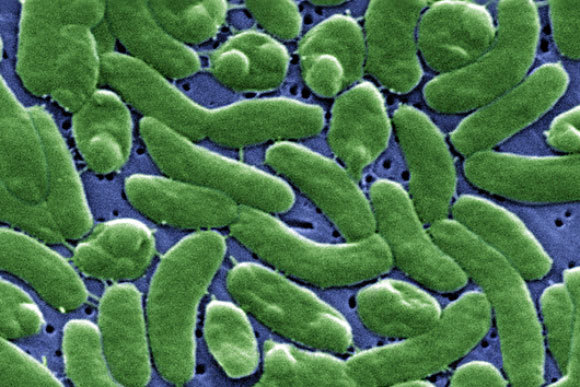 חיידקי Vibrio vulnificus| צילום: CDC / SCIENCE PHOTO LIBRARY