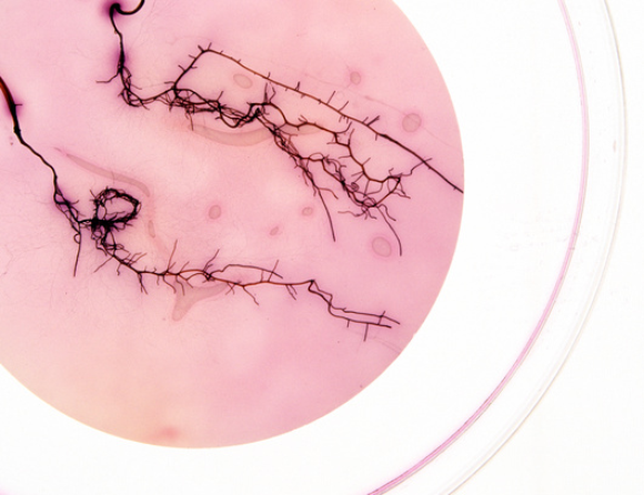 שורשי צמחים שמקיימים יחסי גומלין עם פטריות, בצלחת פטרי | MASSIMO BREGA / EURELIOS / SCIENCE PHOTO LIBRARY