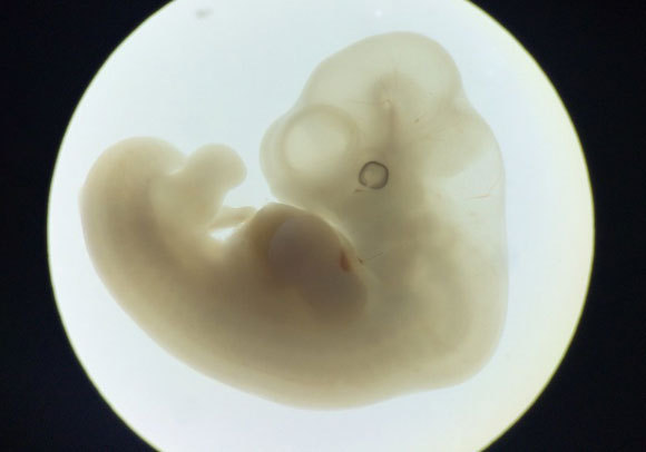 עובר בן פחות מעשרה שבועות | lunar caustic, flickr