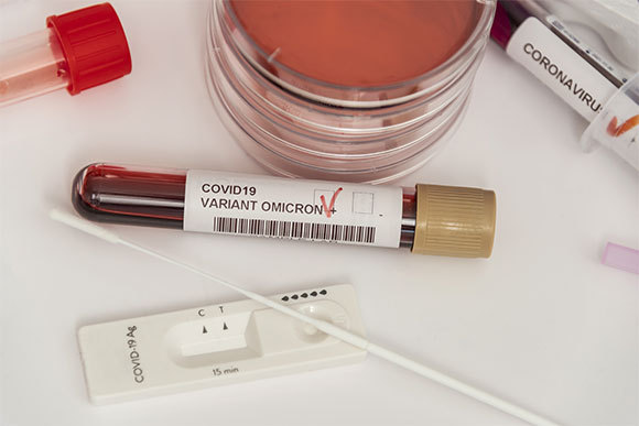 בדיקת דם עם נוגדנים לווריאנט אומיקרון של נגיף הקורונה | צילום: Jbruiz, Shutterstock