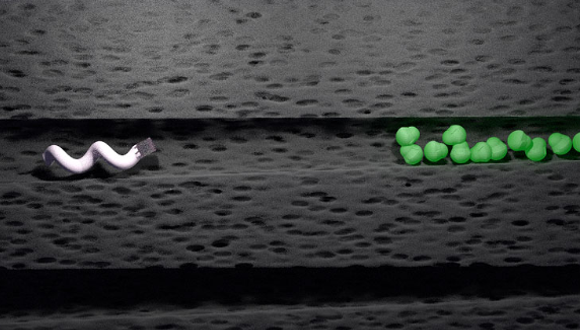 צילום מיקרוסקופ אלקטרונים של ננובוט נע בתעלה בדנטין, לכיוון מושבת חיידקים | Theranautilus