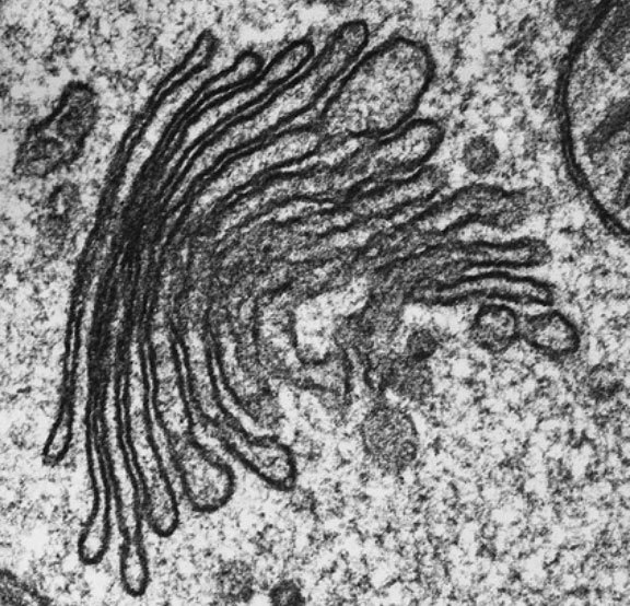 צילום מיקרוסקופ אלקטרונים חודר של גולג'י | Biophoto Associates, Science Photo Library