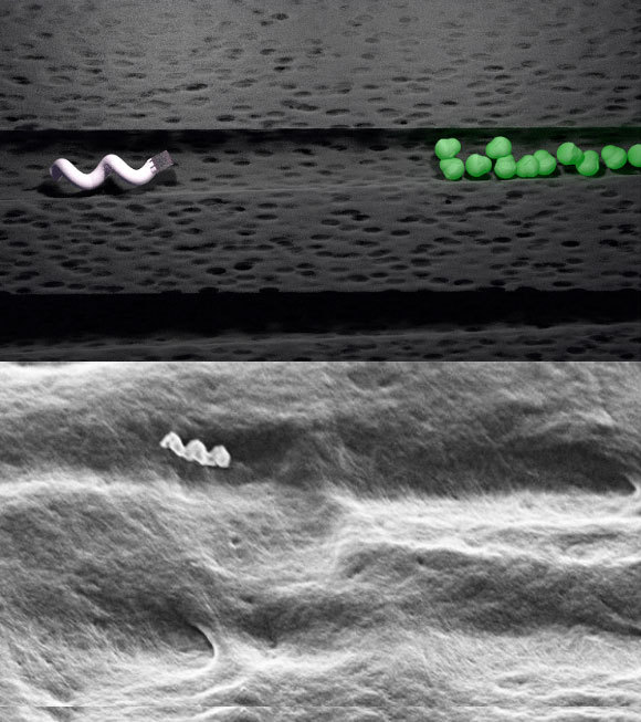 אילוסטרציה (למעלה) וצילום מיקרוסקופ אלקטרונים של ננובוט נע בתעלה בדנטין, לכיוון מושבת חיידקים | Theranautilus