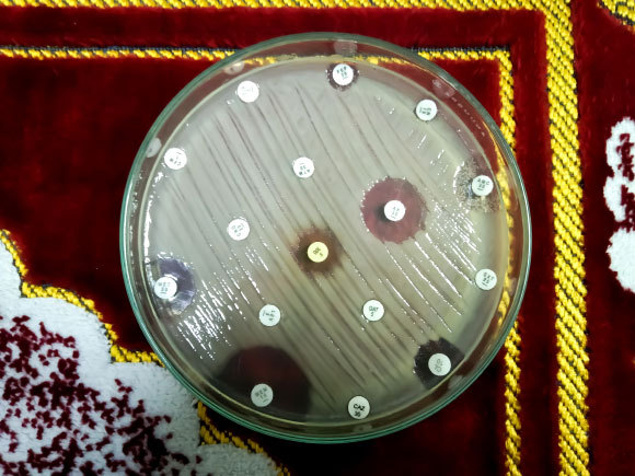 **תמונה של צלחת פטרי** אחד האיומים הגדולים ביותר שעומדים בפני האנושות הוא ההתפתחות של חיידקים שעמידים לסוגים רבים של אנטיביוטיקה. | צילום: Arif biswas Shutterstock