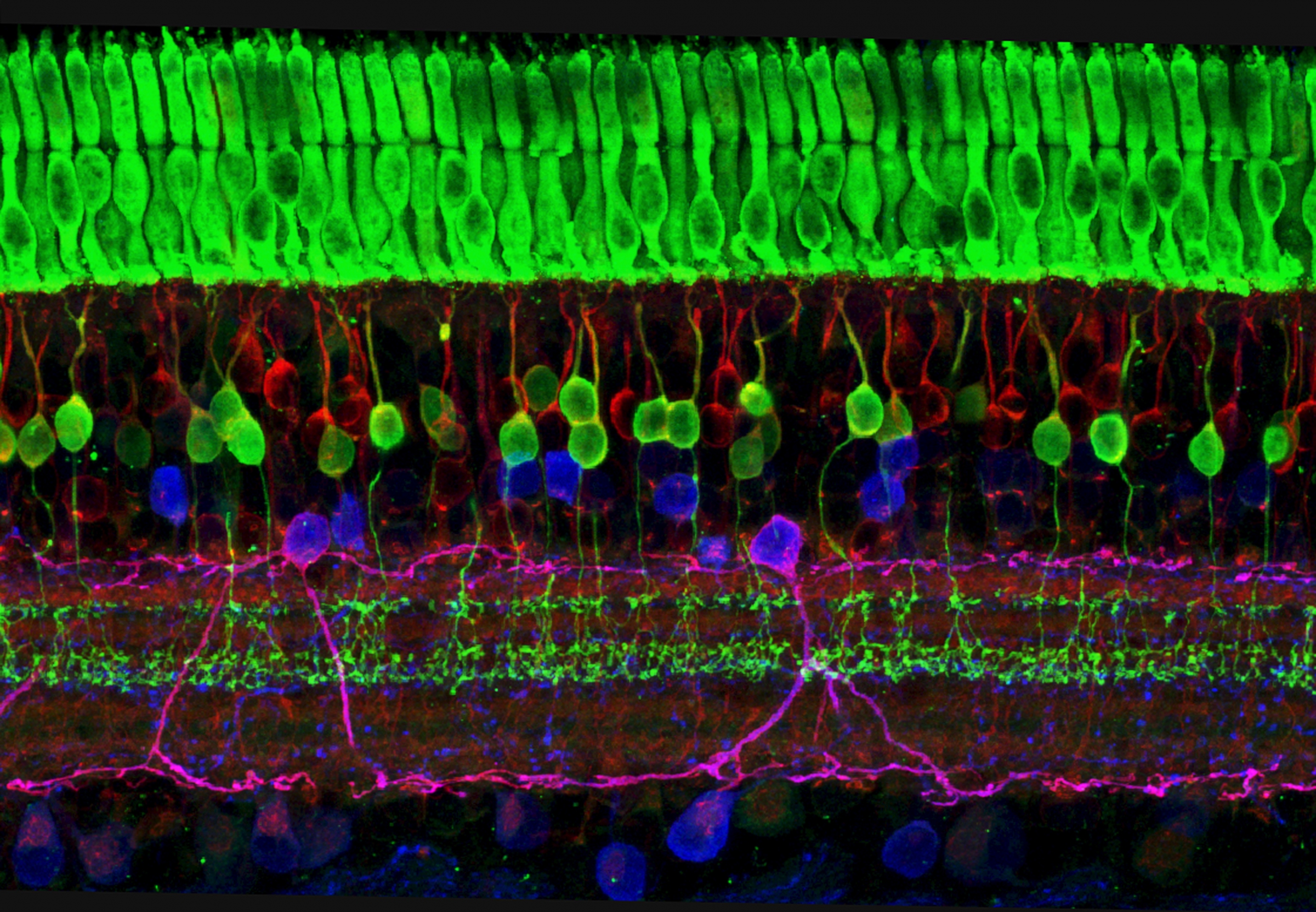 האור צריך לעבור דרך תאי עצבים כדי להגיע לתאים קולטי האור (למעלה בתמונה). מבנה הרשתית | צילום: Science Photo Library