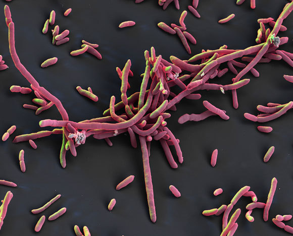 תמונת מיקרוסקופ אלקטרונים של החיידק Aeromonas hydrophila | תמונה: science photo library, Eye of Science