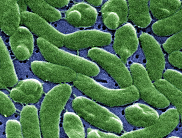 החיידק הטורף vibrio vulnificus | מקור: science photo library, CDC