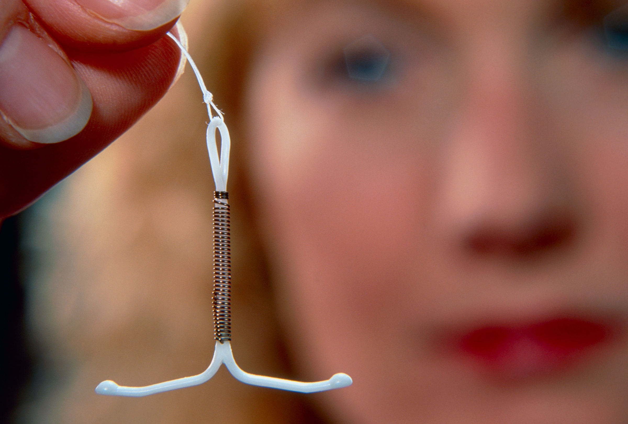 יש גרסאות עם הורמונים וגרסאות בלי הורמונים. אשה מחזיקה התקן תוך רחמי | צילום: SATURN STILLS / SCIENCE PHOTO LIBRARY