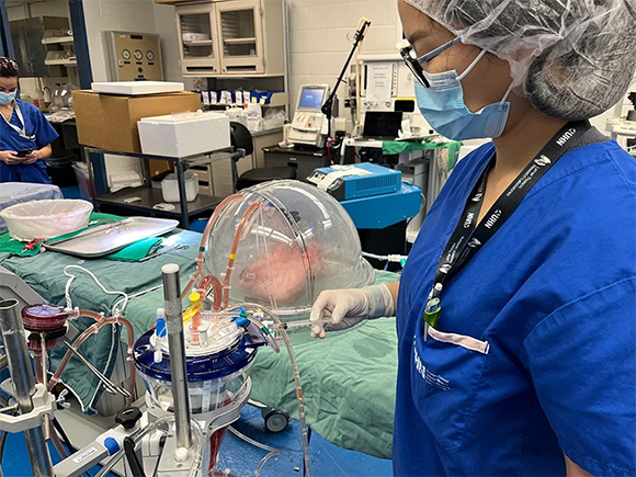 ריאה מטופלת באנזימים | קרדיט: University Health Network