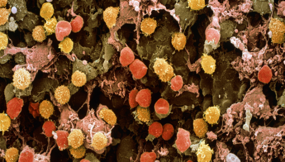 جزء من غدّة ليمفا تحت المجهر الإلكترونيّ الماسح | مصدر:Science Photo Library