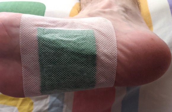 מדבקה במרכז כף רגל ימין | צילום: נעם לויתן