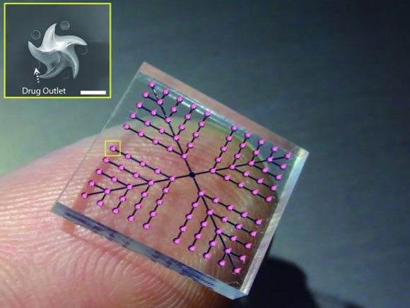 טלאי המחטים הקטן | מתוך W.-G. Bae et al., Science Translational Medicine