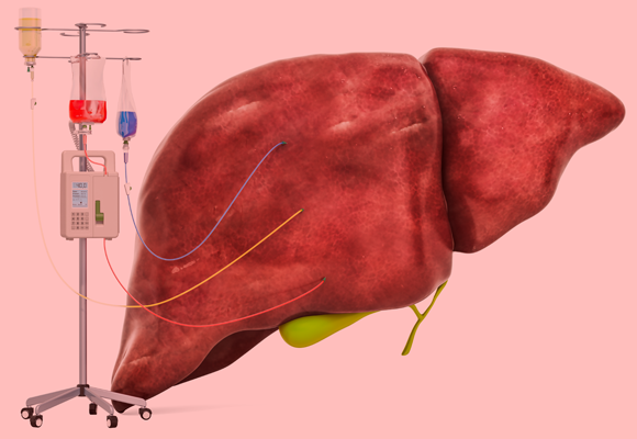 כבד מחובר לעירוי | איור: AlexLMX, Shutterstock