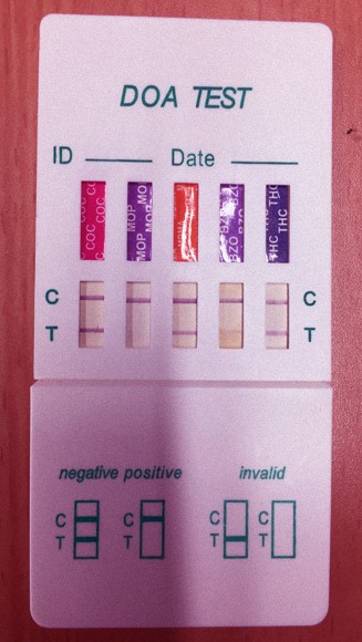 בדיקת הסמים שלי לאחר אכילת עוגת פרג – פס אחד, משמעו 'חיובי' לסמים ממשפחת המורפינים/אופיאטים (MOP) | צילום: ד"ר אבי סאייג