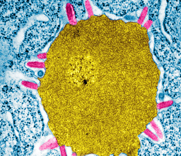 המקור הנפוץ ביותר למחלות זואונוטיות. נגיף של עטלף (LBV) | קרדיט: Science Source, SPL