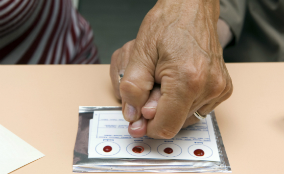 בדיקה של סוגי דם | Science Photo Library