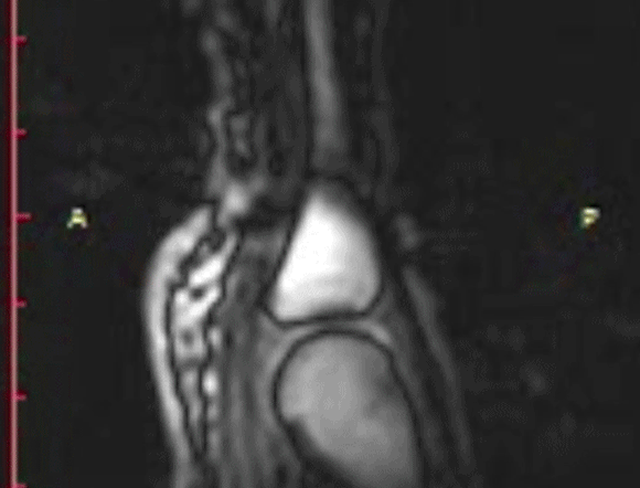 דימות מגנטי (MRI) של "קנאק" בעצמות כף היד | מתוך המאמר של Kawchuk et al., 2015