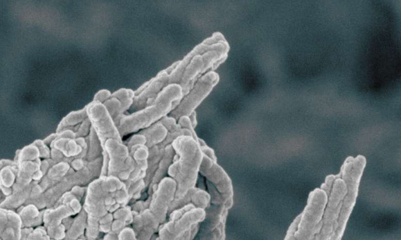 צילום במיקרוסקופ אלקטרונים | צילום: Melinda Duer/ Cathy Shanahan