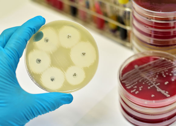 אלח דם הוא גורם המוות המוביל אצל מאושפזים בבתי חולים. צלחות פטרי עם חיידקים | צילום: Shutterstock