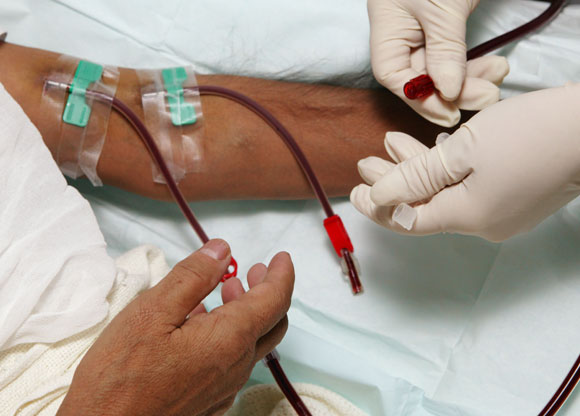 למעלה ממחצית מחלות הכליה הן מחלות שניוניות שבין הגורמים להן סוכרת ויתר לחץ דם. טיפול דיאליזה | צילום: Shutterstock
