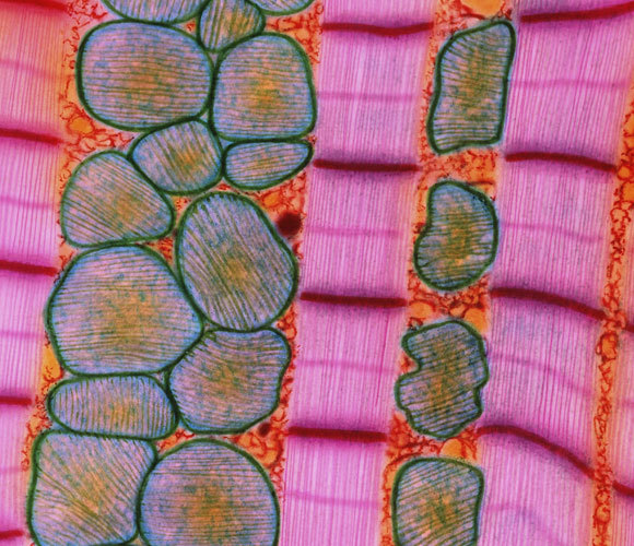 צילום במיקרוסקופ אלקטרונים: STEVE GSCHMEISSNER / SCIENCE PHOTO LIBRARY