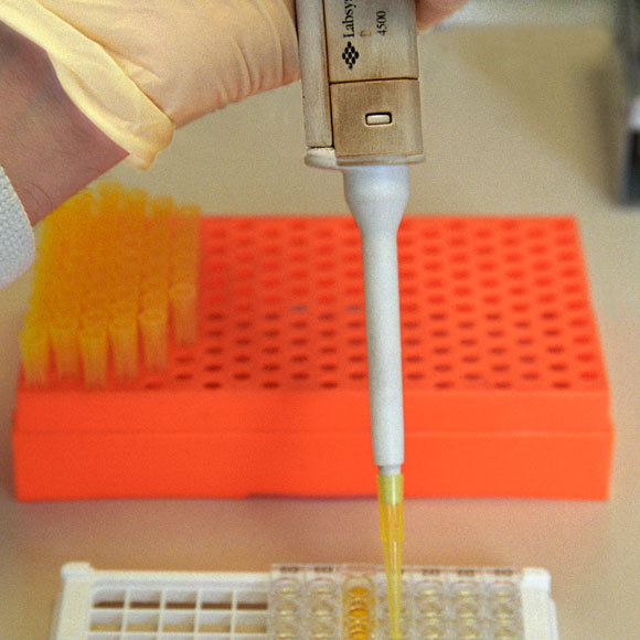 בדיקה מהירה של מאות דגימות במקביל: שיטת ELISA | צילום: SOTIRIS ZAFEIRIS / SCIENCE PHOTO LIBRARY