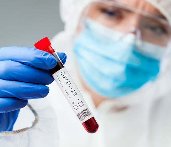 דגימות דם של נבדקים | צילום: Cryptographer, Shutterstock