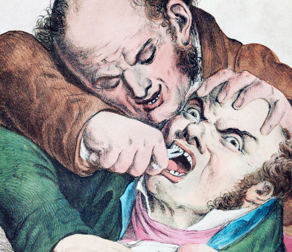 עקירת שיניים במאה ה-19