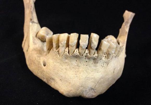 לסת של תושב האיים הבריטיים מלפני 5,500 שנה, שעליה נמצאו שרידי חלב | Dr Sophy Charlton, University of York