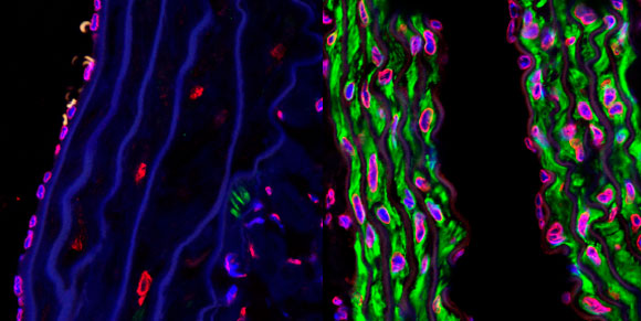 הזדקנות מוקדמת. כלי דם של עכבר חולה פרוגריה עם טיפול (מימין) ובלי טיפול | צילום: Science Photo Library