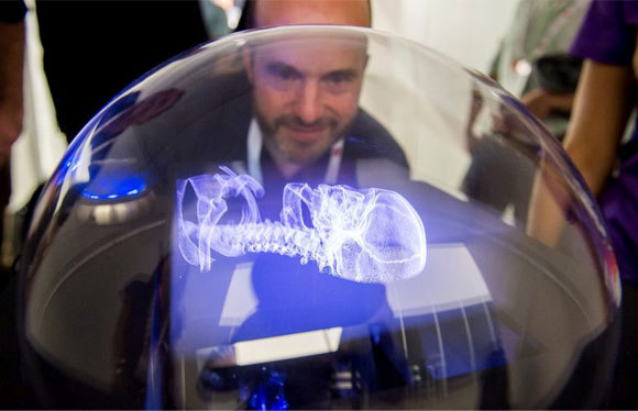 תצוגת תלת-ממד נפחית של חברת Voxon לצרכי המחשה רפואית | צילום: Haggispizza, ויקיפדיה 