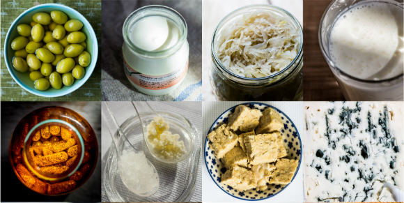 חיידקים בלתי מזיקים שמתחרים עם החיידקים המזיקים. מאכלים פרוביוטיים | צילום: Science Photo Library