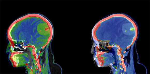 תמונת דימות בסורק CT | מקור: RAJAAISYA, Science Photo Library