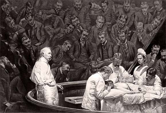 ניתוח הסרת שד לחולה במאה ה-19. על כתפי ענקים | מקור: Chemical Heritage Foundation / Science Photo Library