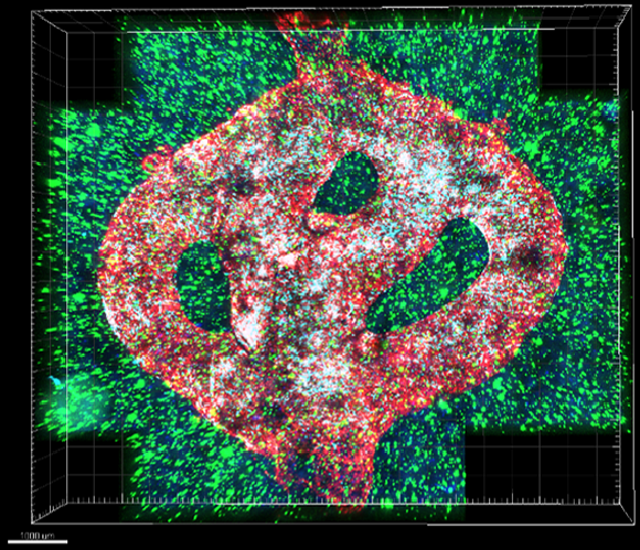 צילום מיקרוסקופי של מודל גליובלסטומה מודפס בתלת-ממד. | צילום: אוניברסיטת תל אביב