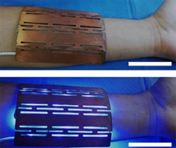 מכשיר הארה שפיתחו החוקרים מספק לאצות אור במידה הדרושה לעידוד ייצור חמצן | מתוך המאמר Miguel Obaíd et al