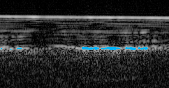 החזרי המכ"מ: הפס העליון הוא פני השטח, הכתם הבהיר בתחתית, צבוע בתכלת, הוא האזור החשוד כמים | מקור: ESA, INAF